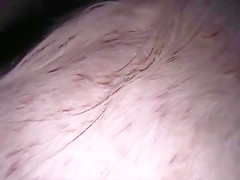Thumb 20