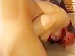Thumb 1